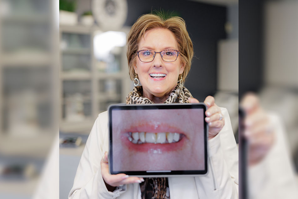 Ideal for those with stained, chipped, or uneven teeth, or seeking a flawless smile transformation.
